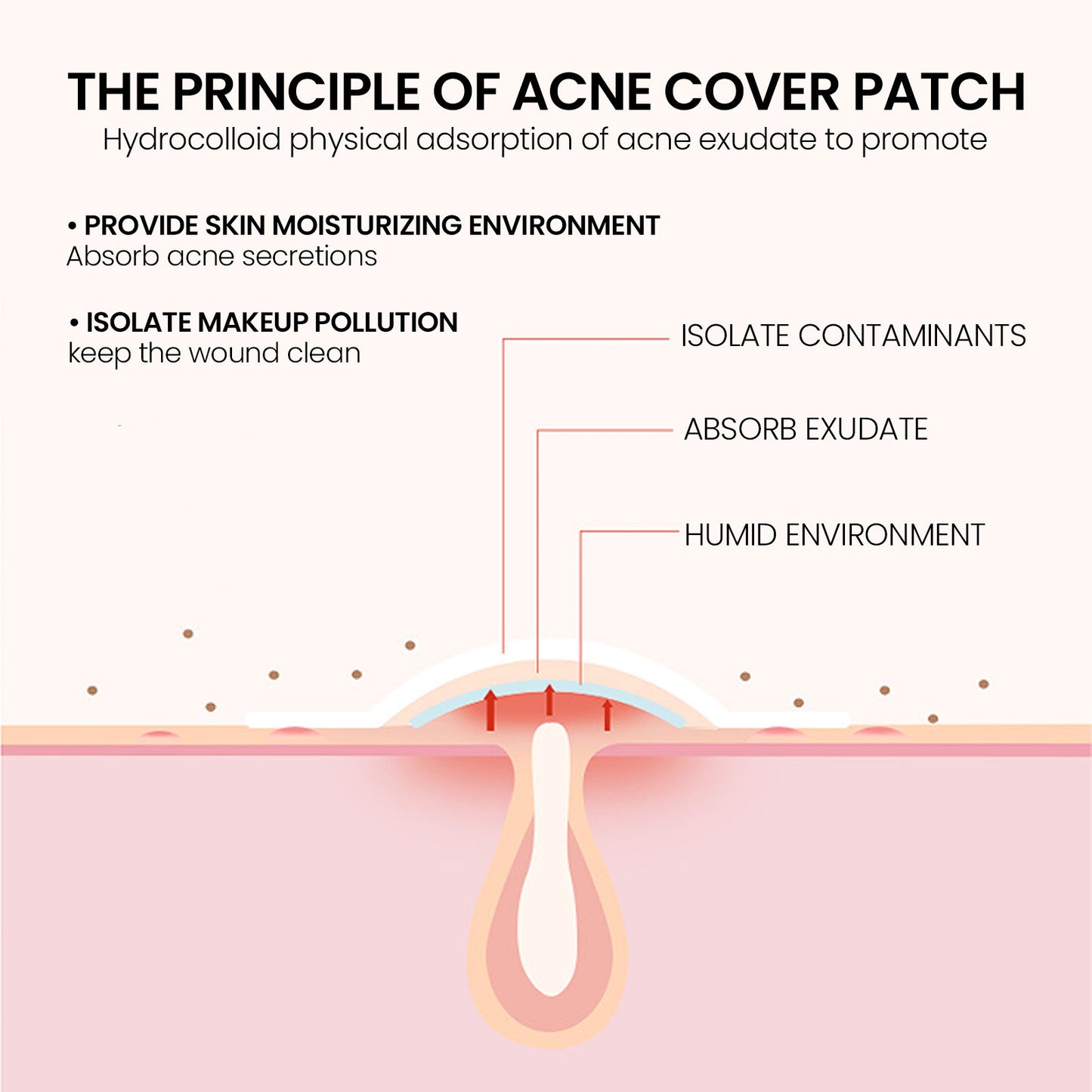 Anti-Acne Pimple Patches (200pcs)